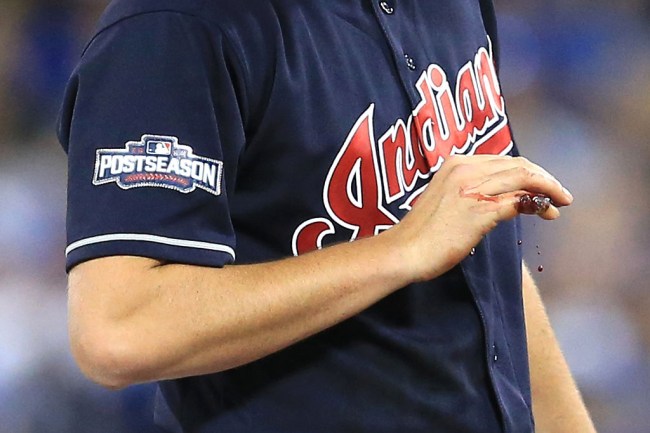 trevor bauer bleeding ALCS