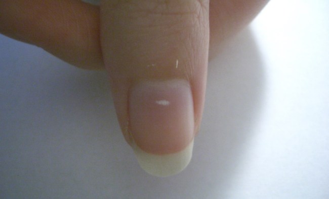Fingernail