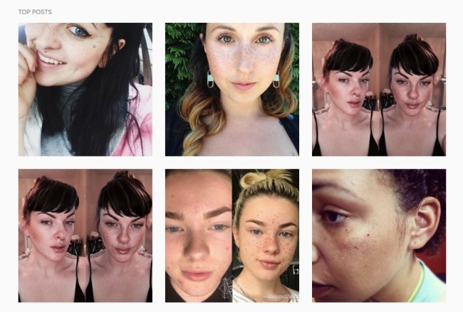freckle tattoos