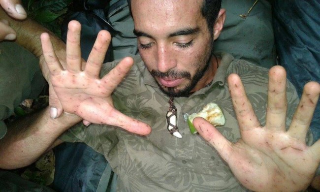 man saved by monkeys