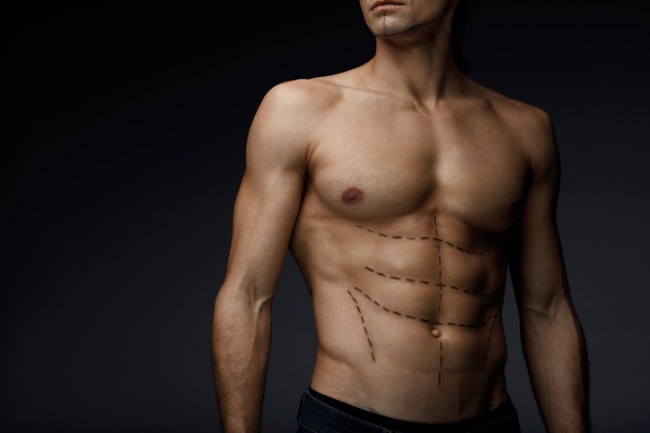Muscle Implants