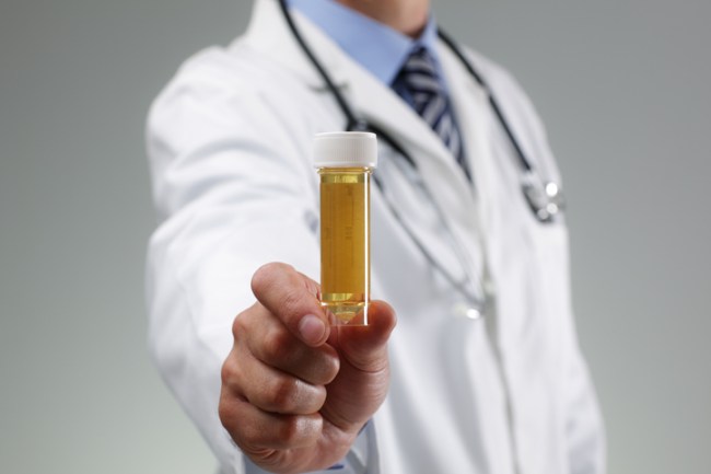 Drug Test Excuses