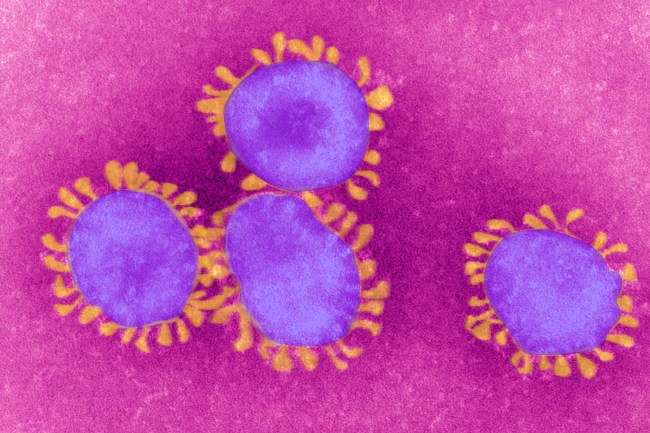 The coronavirus could cause infertility in men according to Chinese research that links COVID-19 to SARS. 