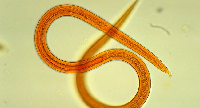 Woman Finds Live Worm Living In Her Tonsils After Having Sore Throat
