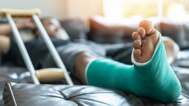 broken bones