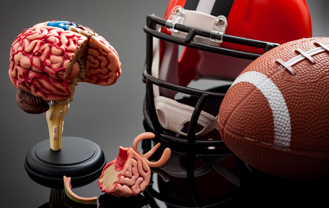 q collar concussion prevention device