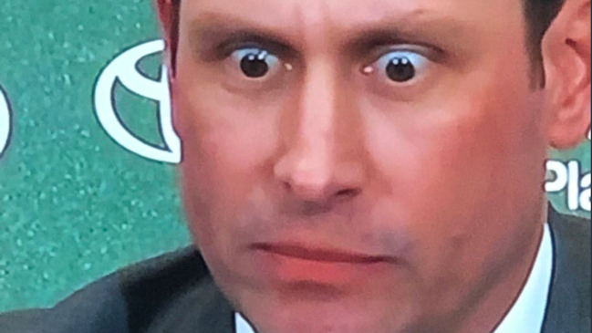 adam gase eyes