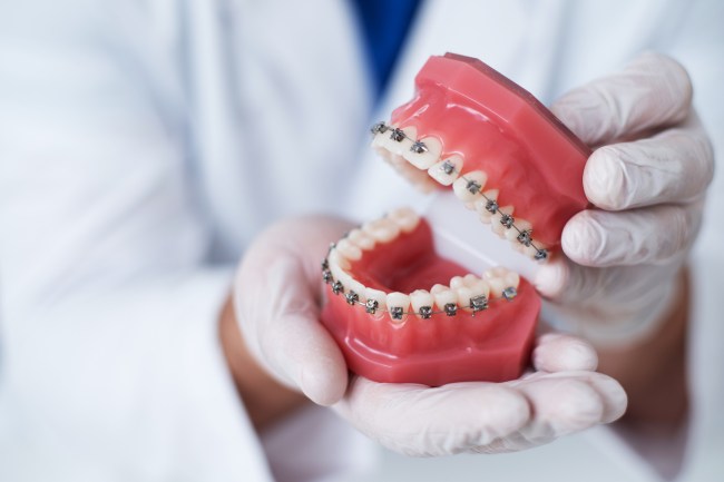 Scientists develop weight loss device that magnetically wires jaw shut so obese people can only eat liquid foods.