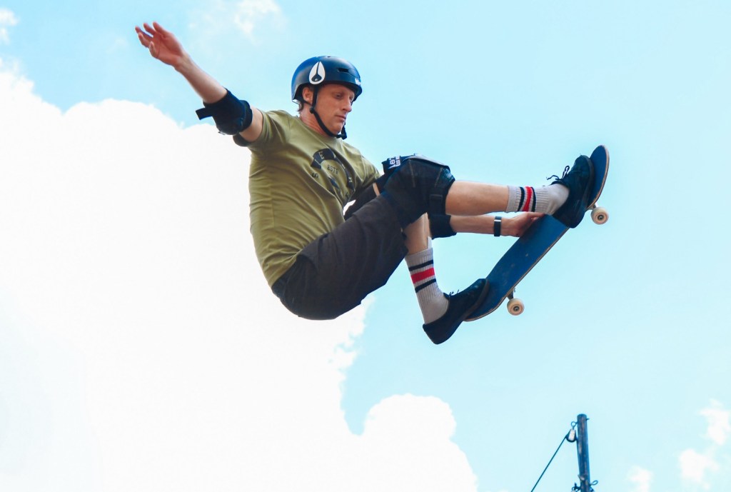 Tony Hawk Breaks His Hand With Bones Sticking Out While Skating Pool