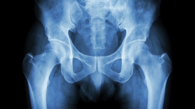 Film x-ray human pelvis no tail