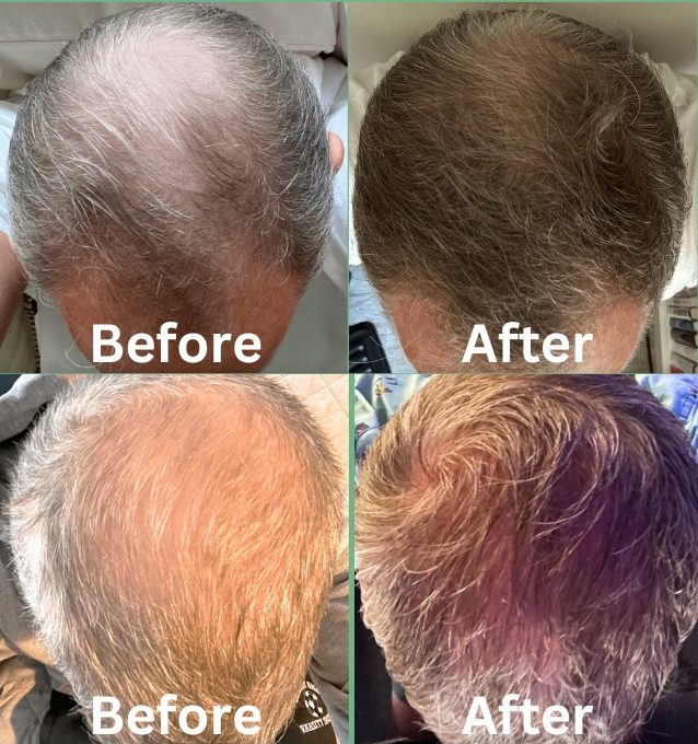Roots by GA before and after