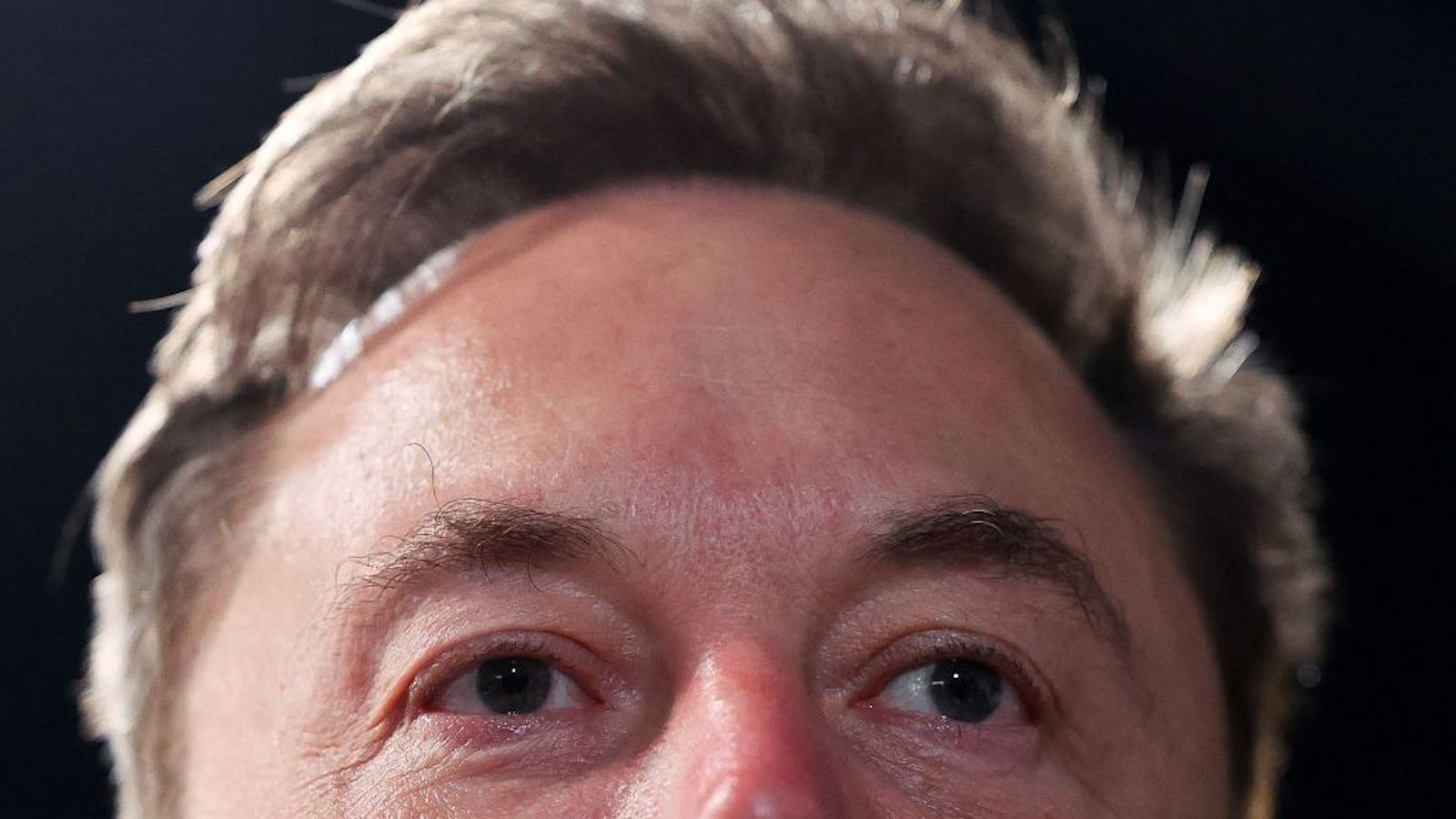 elon-musk-forehead.jpg