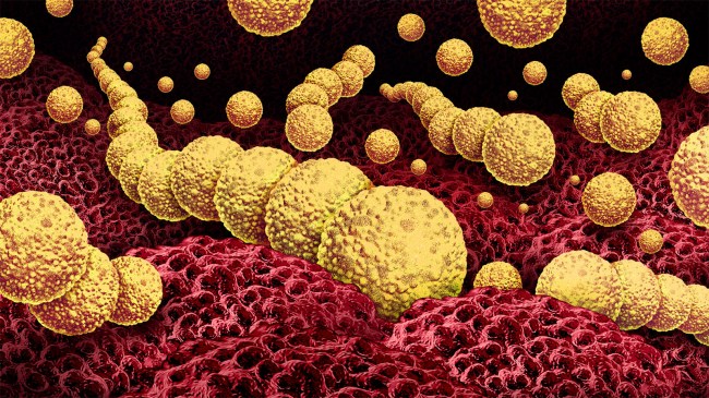 Flesh-Eating-Bacteria